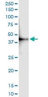 Anti-MVD Polyclonal Antibody Pair