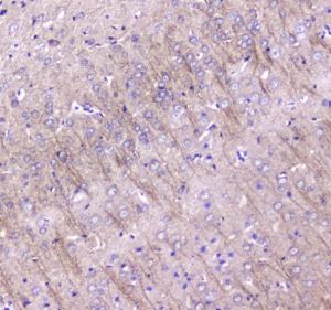 Anti-MAP1LC3A Polyclonal Antibody