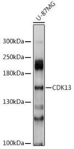 Western blot analysis of extracts of U-87MG cells, using Anti-CDK13 Antibody (A8565) at 1:1,000 dilution The secondary antibody was Goat Anti-Rabbit IgG H&L Antibody (HRP) at 1:10,000 dilution Lysates/proteins were present at 25 µg per lane