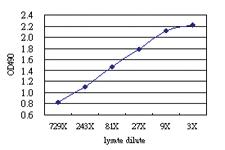 Anti-GRN Antibody Pair