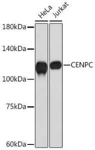 Western blot analysis of extracts of various cell lines, using Anti-CENPC Antibody [ARC2097] (A309070) at 1:1,000 dilution The secondary antibody was Goat Anti-Rabbit IgG H&L Antibody (HRP) at 1:10,000 dilution Lysates/proteins were present at 25 µg per lane