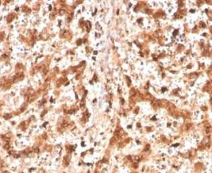 Immunohistochemical analysis of formalin-fixed, paraffin-embedded human liver tissue using Anti-Cathepsin D Antibody [CTSD/4497]