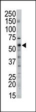 Anti-Serine Palmitoyltransferase (SPTLC2) Rabbit Polyclonal Antibody