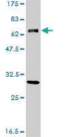 Anti-ERCC2 Mouse Monoclonal Antibody [clone: S3]