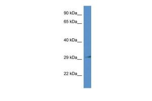 Anti-RPSA Rabbit Polyclonal Antibody