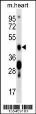 Anti-CAMK4 Rabbit Polyclonal Antibody (APC (Allophycocyanin))