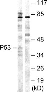 Anti-p53 Rabbit Polyclonal Antibody