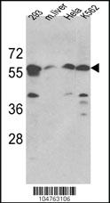 Anti-SPTLC1 Rabbit Polyclonal Antibody