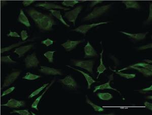 Anti-ERCC2 Mouse Monoclonal Antibody [clone: S3]