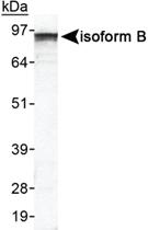 Anti-EPB41L3 Rabbit Polyclonal Antibody