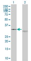 Anti-UCP2 Mouse Polyclonal Antibody