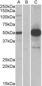 HEK293 lysate (10ug protein in RIPA buffer) overexpressing Human COPS3 with DYKDDDDK tag probed with Anti-COPS3 Antibody (A84879) (1.0µg/ml) in Lane A and probed with anti-DYKDDDDK Tag (1/5000) in lane C