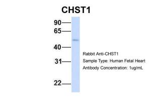 Anti-CHST1 Rabbit Polyclonal Antibody