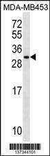 Anti-MRPS10 Rabbit Polyclonal Antibody (AP (Alkaline Phosphatase))