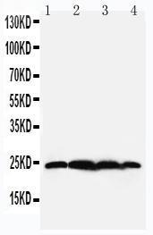 Anti-BAG2 Rabbit Polyclonal Antibody