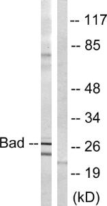 Western blot analysis of lysates from mouse liver using Anti-BAD Antibody. The right hand lane represents a negative control, where the antibody is blocked by the immunising peptide