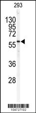 Anti-SPTLC1 Rabbit Polyclonal Antibody