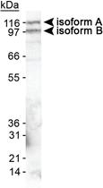 Anti-EPB41L3 Rabbit Polyclonal Antibody