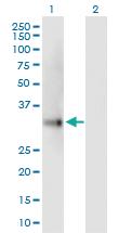 Anti-UCP2 Mouse Polyclonal Antibody