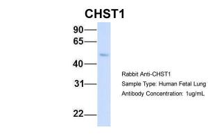 Anti-CHST1 Rabbit Polyclonal Antibody