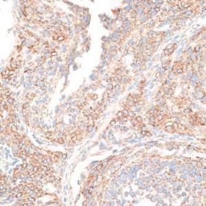 Immunohistochemistry analysis of paraffin-embedded rat ovary using Anti-KIF14 Antibody (A8568) at a dilution of 1:100 (40x lens) Perform microwave antigen retrieval with 10 mM PBS buffer pH 72 before commencing with IHC staining protocol