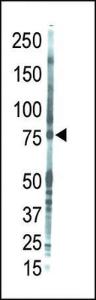 Anti-PRKCQ Rabbit Polyclonal Antibody (APC (Allophycocyanin))