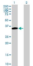 Anti-B4GALT7 Mouse Polyclonal Antibody