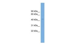 Anti-AS3MT Rabbit Polyclonal Antibody