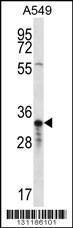 Anti-OR4F5 Rabbit Polyclonal Antibody (FITC (Fluorescein Isothiocyanate))