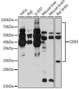 Western blot analysis of extracts of various cell lines, using Anti-CD83 Antibody [ARC0935] (A307830) at 1:1000 dilution