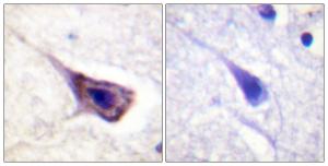 Immunohistochemical analysis of paraffin-embedded human brain tissue using Anti-BAD Antibody. The right hand panel represents a negative control, where the antibody was pre-incubated with the immunising peptide