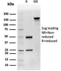 SDS-PAGE analysis of Anti-Cathepsin D Antibody [CTSD/4497] under non-reduced and reduced conditions; showing intact IgG and intact heavy and light chains, respectively. SDS-PAGE analysis confirms the integrity and purity of the antibody