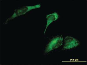 Anti-ARL8A Mouse Monoclonal Antibody [clone: 3H4]