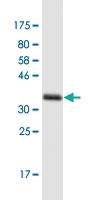 Anti-PRPSAP1 Mouse Monoclonal Antibody [clone: 5H10]