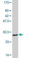 Anti-SLC11A1 Mouse Monoclonal Antibody [clone: 2G2]