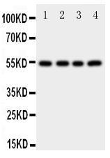 Anti-Cystatin A Rabbit Polyclonal Antibody