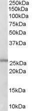 Anti-GSTM1/GSTM2 Antibody (A83264) (03 µg/ml) staining of Human Lung lysate (35 µg protein in RIPA buffer) Primary incubation was 1 hour Detected by chemiluminescence