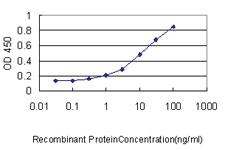 Anti-SCGB1A1 Mouse Monoclonal Antibody [clone: 4A5-A11]