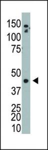 Anti-ADK Rabbit Polyclonal Antibody (FITC (Fluorescein Isothiocyanate))