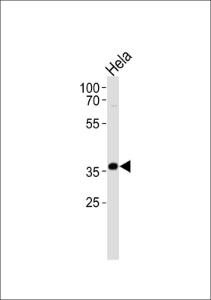 Anti-AKR1C3 Rabbit Polyclonal Antibody (Biotin)