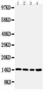 Anti-Stefin B Rabbit Polyclonal Antibody