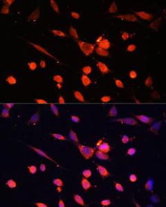 Immunofluorescence analysis of NIH-3T3 cells using Anti-PI 3 Kinase p55 gamma Antibody (A92970) at a dilution of 1:100. DAPI was used to stain the cell nuclei (blue)