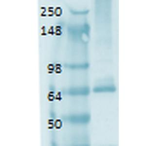 Western blot analysis of human thyroid lysate showing detection of Sodium Iodide Symporter protein using Anti-Sodium Iodide Symporter Antibody [14F] (A305039) at 1:1,000