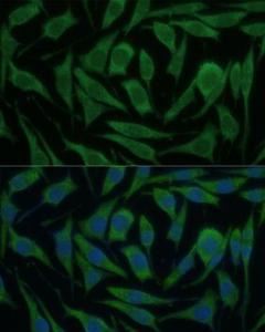 Immunofluorescence analysis of L929 cells using Anti-KIF14 Antibody (A8568) at a dilution of 1:100 (40x lens) DAPI was used to stain the cell nuclei (blue)