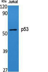 Anti-p53 Rabbit Polyclonal Antibody