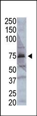 Anti-ACSL4 Rabbit Polyclonal Antibody