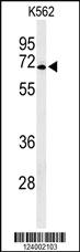 Anti-IL25 Rabbit Polyclonal Antibody