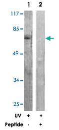 Anti-RAF1 Rabbit Polyclonal Antibody