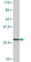 Anti-ABCD1 Mouse Polyclonal Antibody