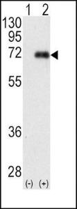 Anti-PRKCI Rabbit Polyclonal Antibody (AP (Alkaline Phosphatase))